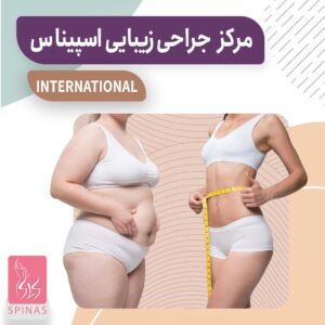 دکتر کیوان مهدی نژاد متخصص لاپاراسکوپی,لیپوساکشن, لیپوماتیک,