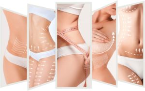 دکتر کیوان مهدی نژاد متخصص لاپاراسکوپی,لیپوساکشن, لیپوماتیک,