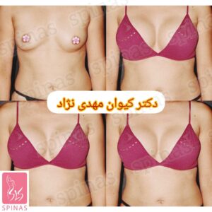 دکتر کیوان مهدی نژاد متخصص لاپاراسکوپی,لیپوساکشن, بلفاروپلاستی,جراحی پستان,