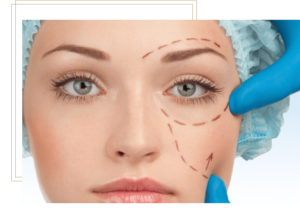 دکتر کیوان مهدی نژاد متخصص لاپاراسکوپی,لیپوساکشن, بلفاروپلاستی, 